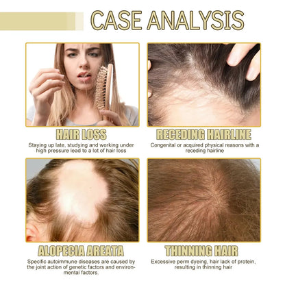 Hair Growth Products Fast Growing Hair Loss Treatment Oil Beauty Health Hair Care for Men Women