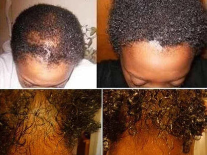 Magical Hair Growth Oil,Regrowth Serum,Hair Loss, Men Hairloss, Women Hair Loss, Kids Hairless Infused Jamaican Black Castor Oil